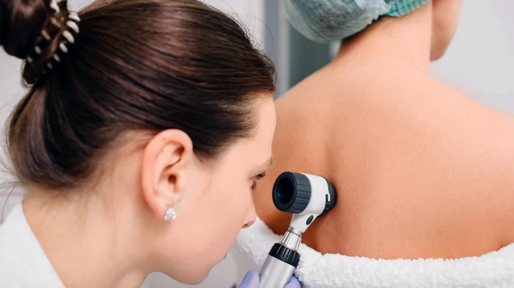 Dermatolog Saç Dökülmesine Bakar mı?