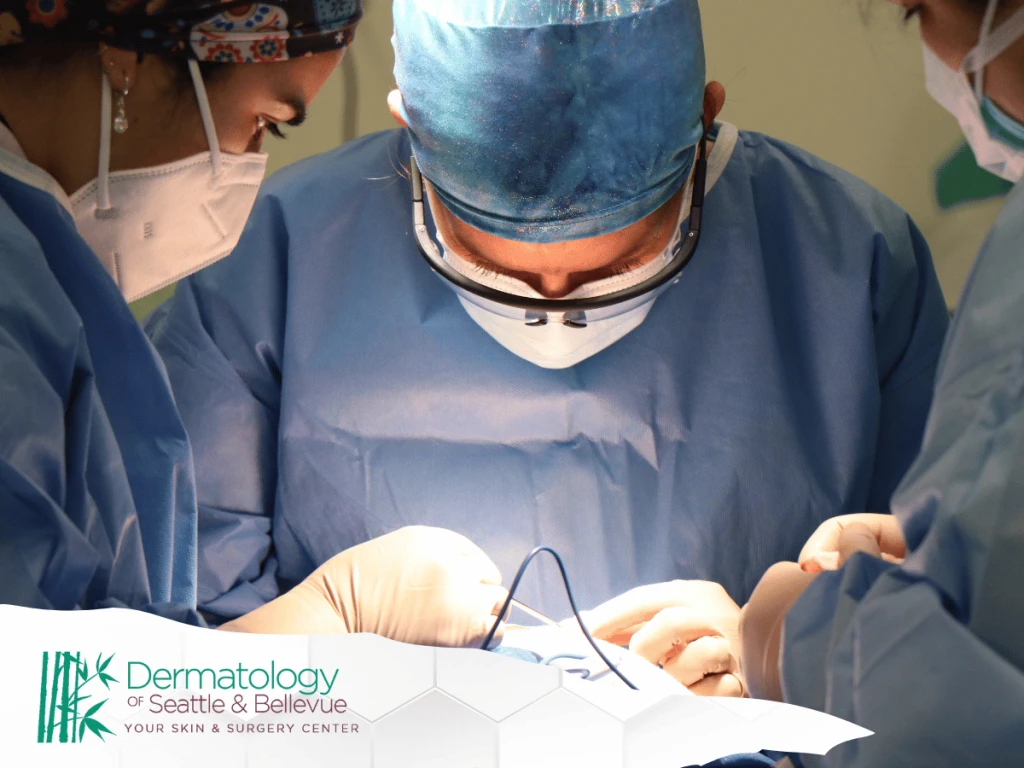 Mohs cerrahı, cilt kanseri tedavisi, cilt cerrahisi, deri t&uuml;m&ouml;r&uuml;, mikrocerrahi, cilt sağlığı, cil