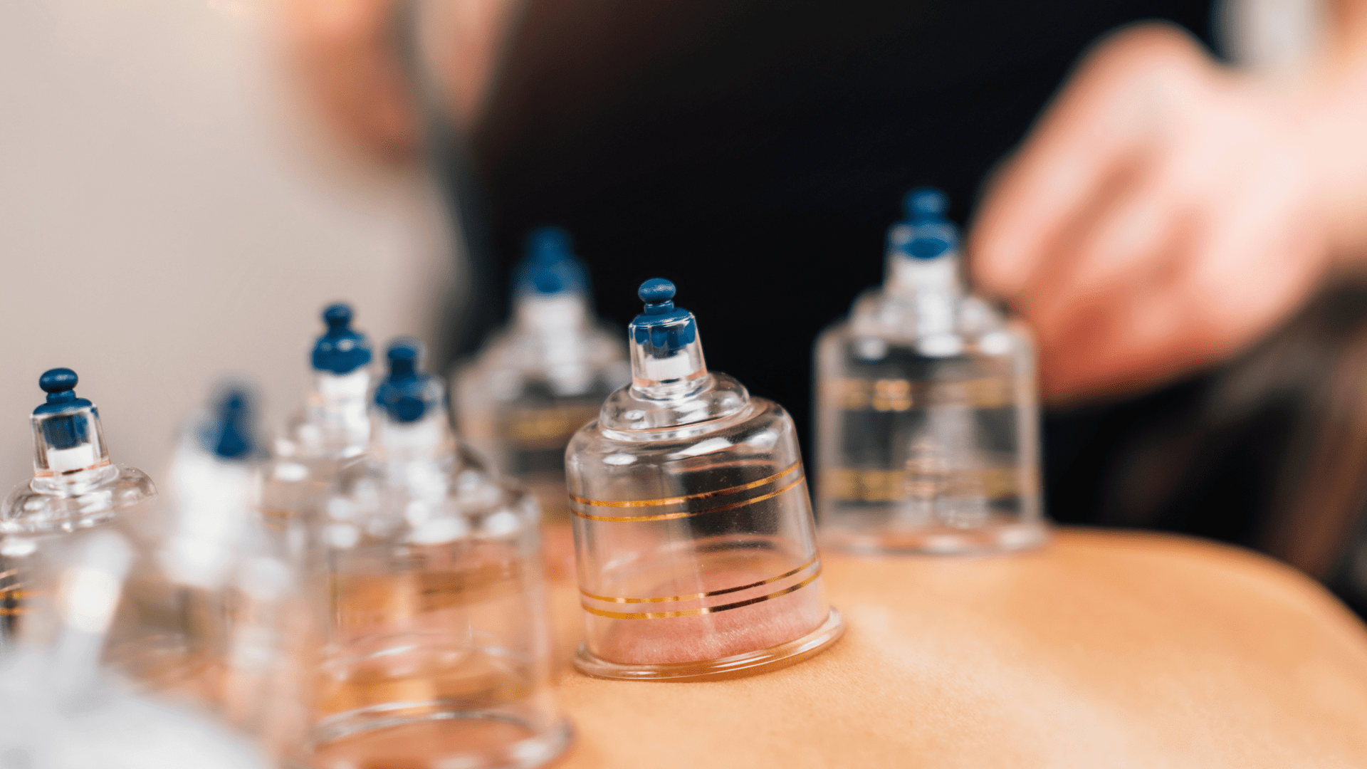 Hacamat faydaları, Sülük tedavisi, Geleneksel sağlık yöntemleri, Kan dolaşımını artırma, Vücut de