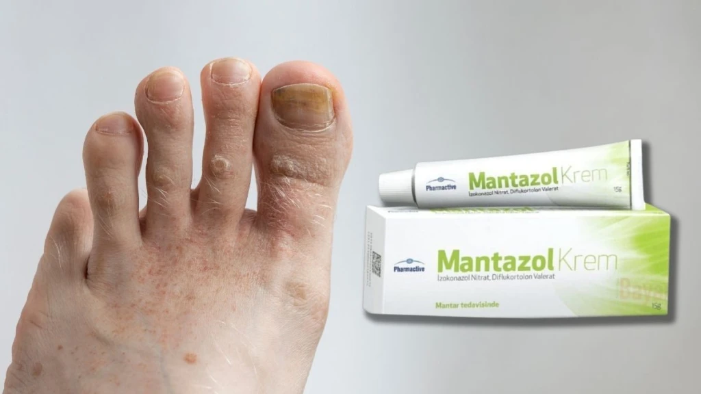 Mantazol Krem Nedir? Ne İşe Yarar? Nasıl Kullanılır?