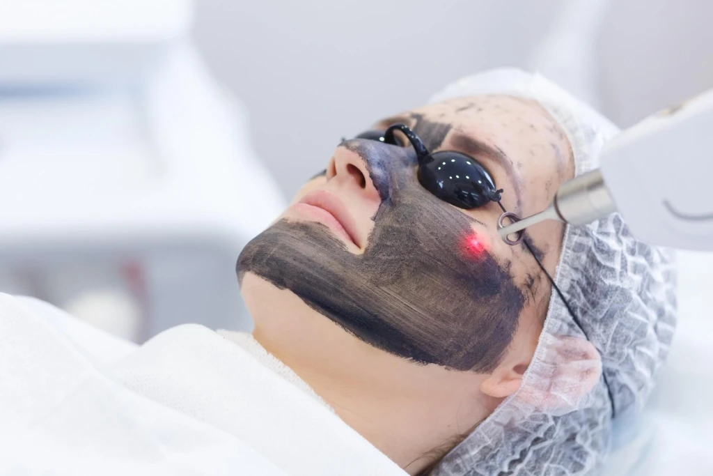Karbon Peeling Ne İşe Yarar? Faydaları Zararları ve Yan Etkileri Nelerdir?