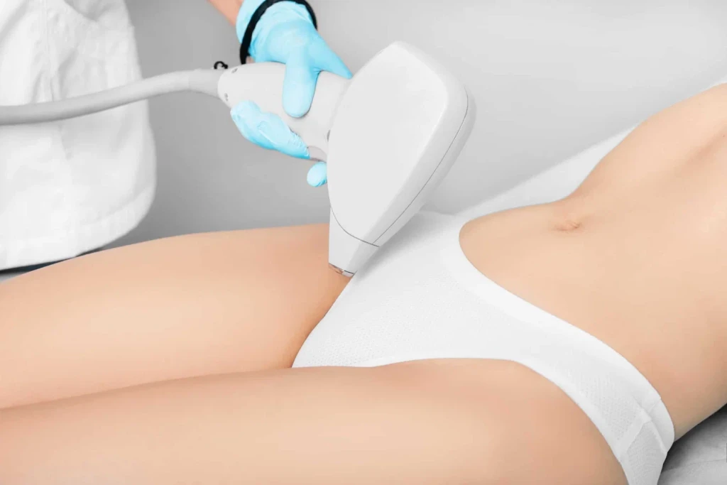 Bikini Bölgesine Lazer Epilasyon Nasıl Yapılır?