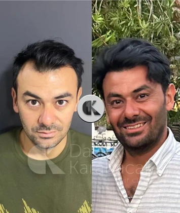 Davut Karabacak Saç Ekim Merkezi Davut Karabacak Saç Ekim Merkezi