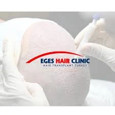Denizli Saç Ekim Merkezi - Eges Hair Clinic - Hair Transplant Denizli Saç Ekim Merkezi - Eges Hair Clinic - Hair Transplant