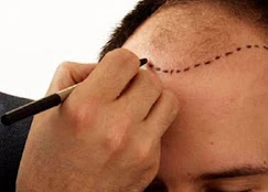 Rize Saç Ekim Merkezi - Hair Clinic Rize Saç Ekim Merkezi - Hair Clinic