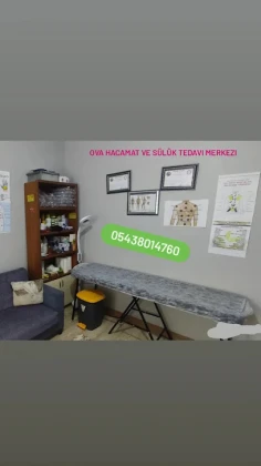Yüksekova Hacamat Ve Sülük Tedavisi Yüksekova Hacamat Ve Sülük Tedavisi