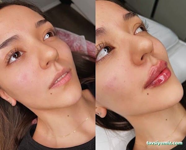 Rubella Medical Estetik Güzellik Ve Sağlık Merkezi Ağrı Rubella Medical Estetik Güzellik Ve Sağlık Merkezi Ağrı