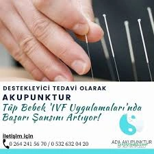 Ada Akupunktur Ada Akupunktur
