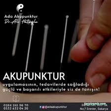 Ada Akupunktur Ada Akupunktur