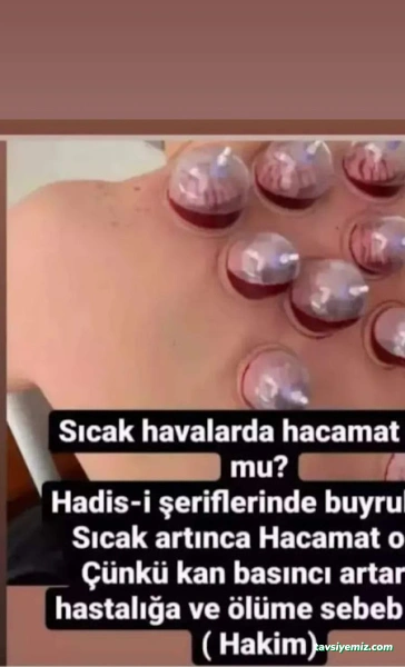 Afyon Hacamat Afyon Hacamat