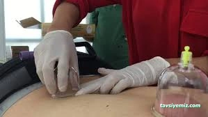 Akupunktur Burdur Akupunktur Burdur