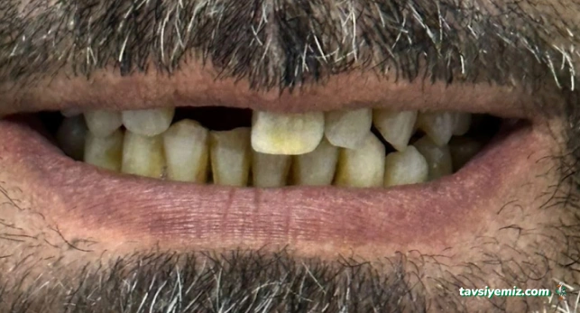 Altan Klinik  Diş Hekimi Fikret Altan