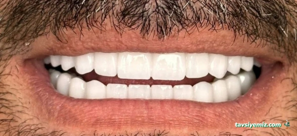 Altan Klinik  Diş Hekimi Fikret Altan