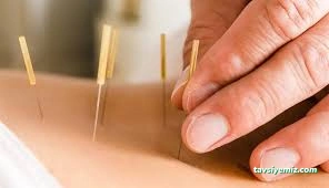 Antakya Hatay Akupunktur Klinik Kapanmıştır. Herkese Teşekkür Ederiz Antakya Hatay Akupunktur Klinik Kapanmıştır. Herkese Teşekkür Ederiz