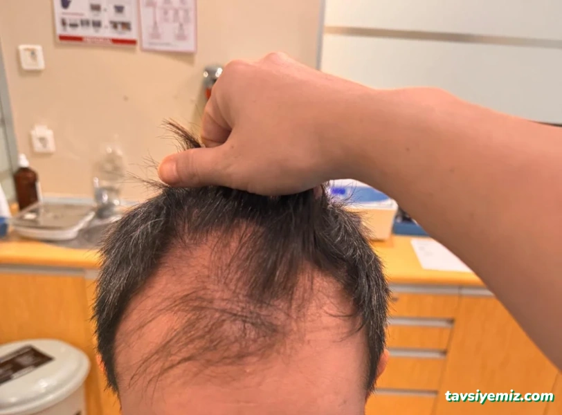Bilyana Hair Clinic Saç Ekim Merkezi Bilyana Hair Clinic Saç Ekim Merkezi