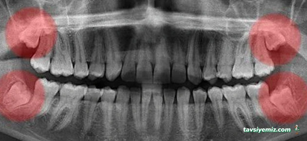 Dent 01 Çene Cerrahisi