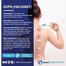 Diyarbakır Kayapınar Hacamat & Tıbbi Sülük Diyarbakır Kayapınar Hacamat & Tıbbi Sülük