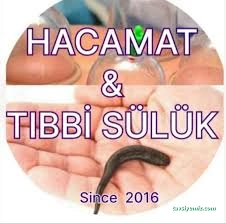 Diyarbakır Kayapınar Hacamat & Tıbbi Sülük Diyarbakır Kayapınar Hacamat & Tıbbi Sülük