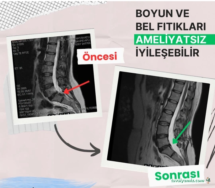 Fizyoterapi Ve Alternatif Tıp Merkezi Fizyoterapi Ve Alternatif Tıp Merkezi