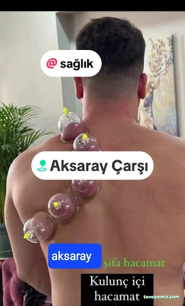Hacamat Sağlıklı Yaşam Merkezi Aksaray68 Hacamat Sağlıklı Yaşam Merkezi Aksaray68