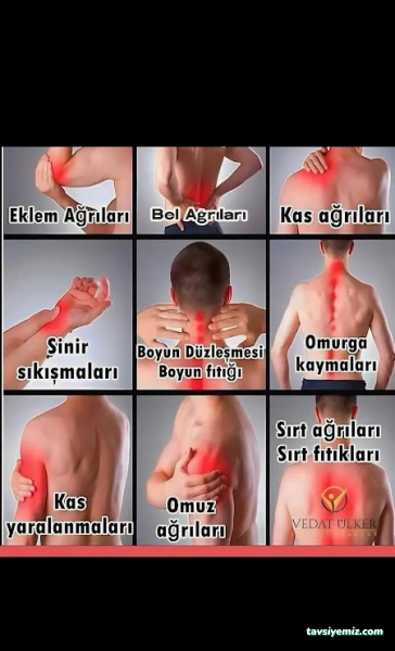 Hacamat Sağlıklı Yaşam Merkezi Aksaray68 Hacamat Sağlıklı Yaşam Merkezi Aksaray68