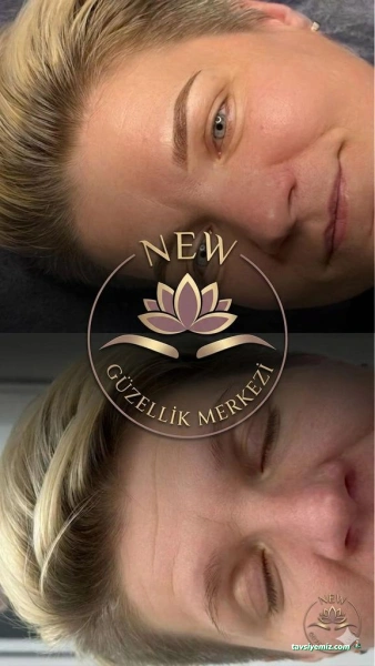 New Güzellik Estetik