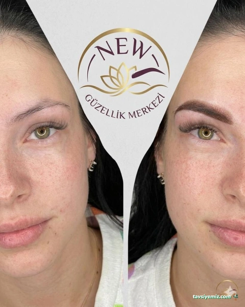 New Güzellik Estetik