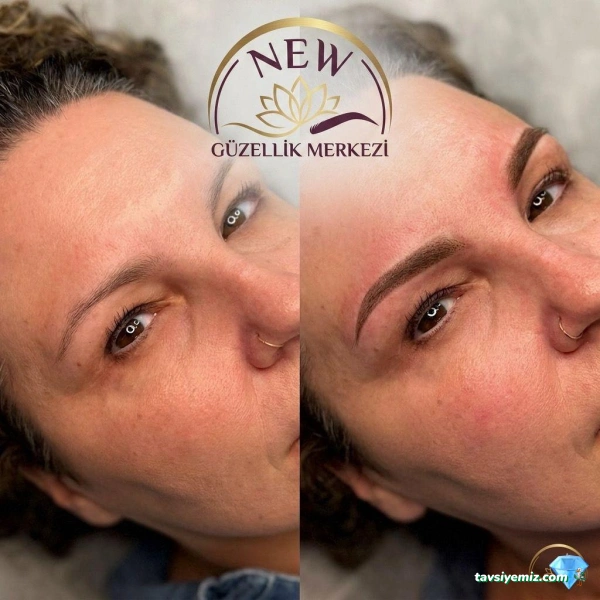 New Güzellik Estetik