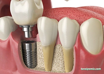 Özel Ceren Dental Ağız Ve Diş Sağlığı Polikliniği Özel Ceren Dental Ağız Ve Diş Sağlığı Polikliniği