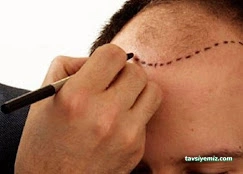 Rize Saç Ekim Merkezi - Hair Clinic