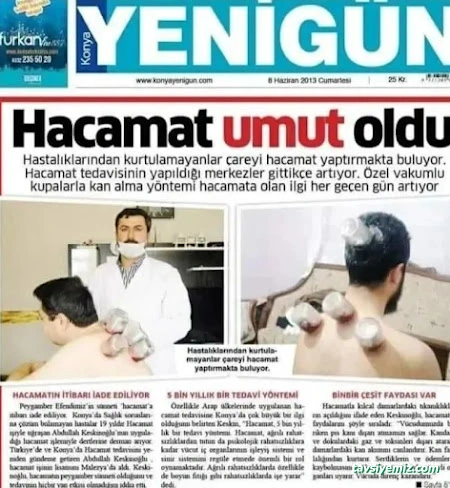 Samsun Hacamat Şifahane (Shiffa Home) Samsun Hacamat Şifahane (Shiffa Home)