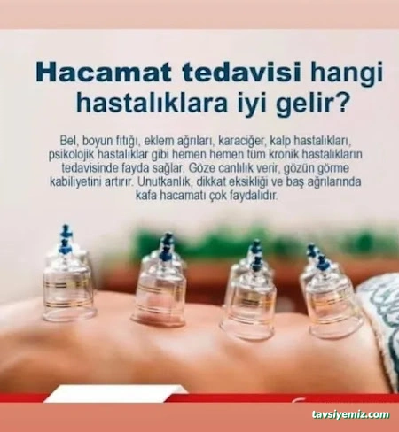 Samsun Hacamat Şifahane (Shiffa Home) Samsun Hacamat Şifahane (Shiffa Home)