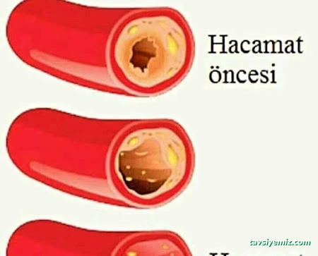 Samsun Hacamat Şifahane (Shiffa Home) Samsun Hacamat Şifahane (Shiffa Home)