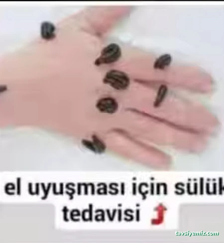 Yüksekova Hacamat Ve Sülük Tedavisi Yüksekova Hacamat Ve Sülük Tedavisi